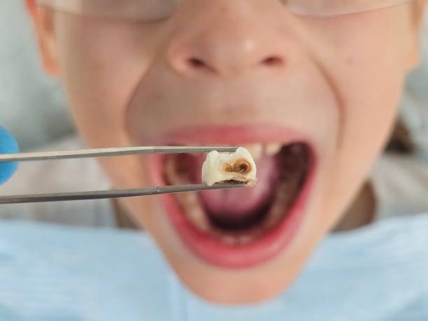 Best Urgent Dental Care for Toothache in Pymatuning Central, PA